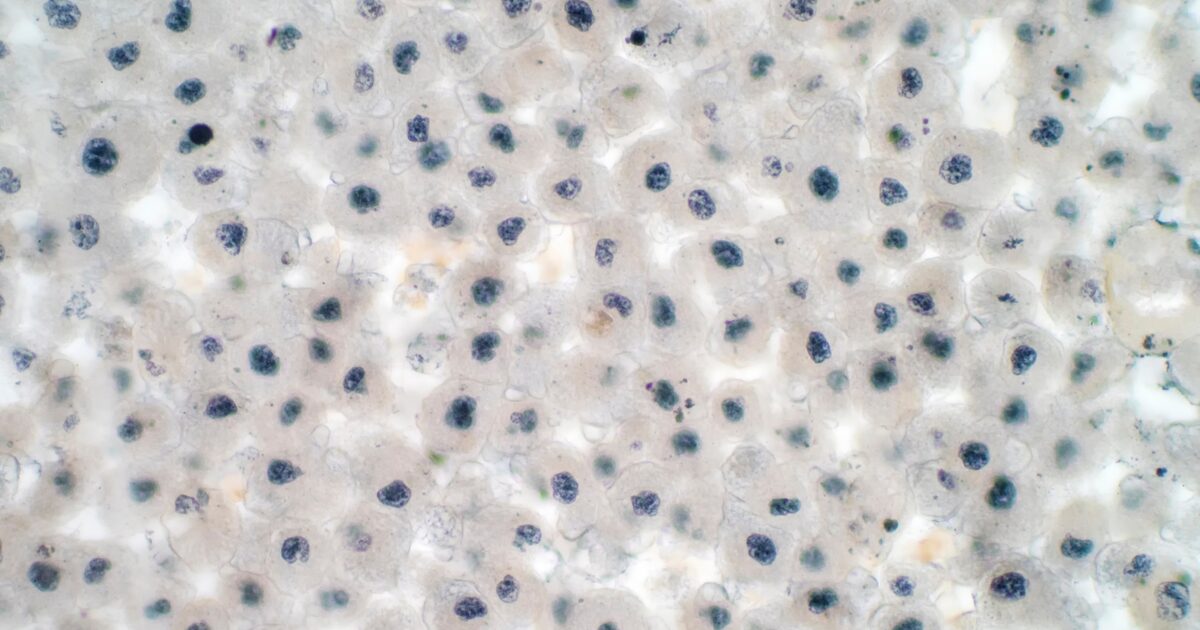 ipamorelin cjc-1295 igf-1 increase percentage PEPTIDE TALK  First and foremost, I want to make it very clear that I am  NOT a peptide expert, nor am I prescribe, recommend, or supervise peptide  use. I've personally been